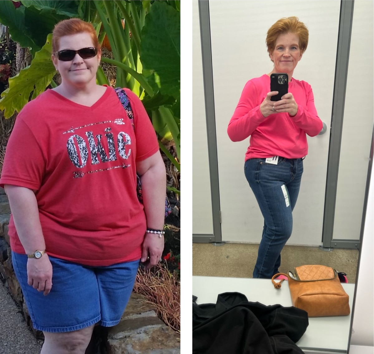 Melissa Purdy finds overall health improvement after bariatric surgery