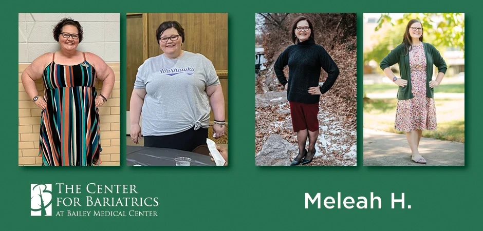 meleah before and after weight loss photos
