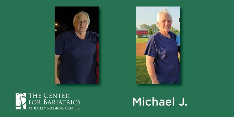 michael before and after weight loss photos