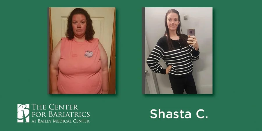 shasta before and after weight loss photos