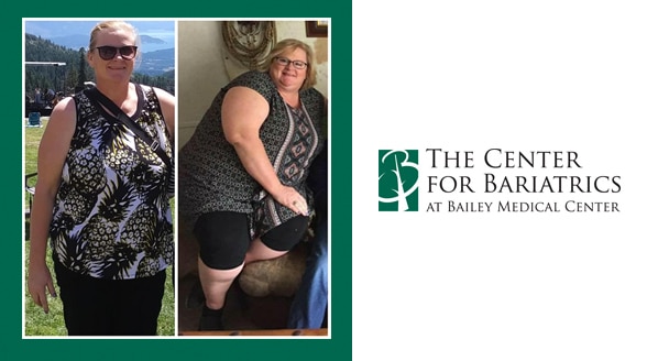 Muskogee Woman Says Life has changed “Night and Day” Since Bariatric Surgery