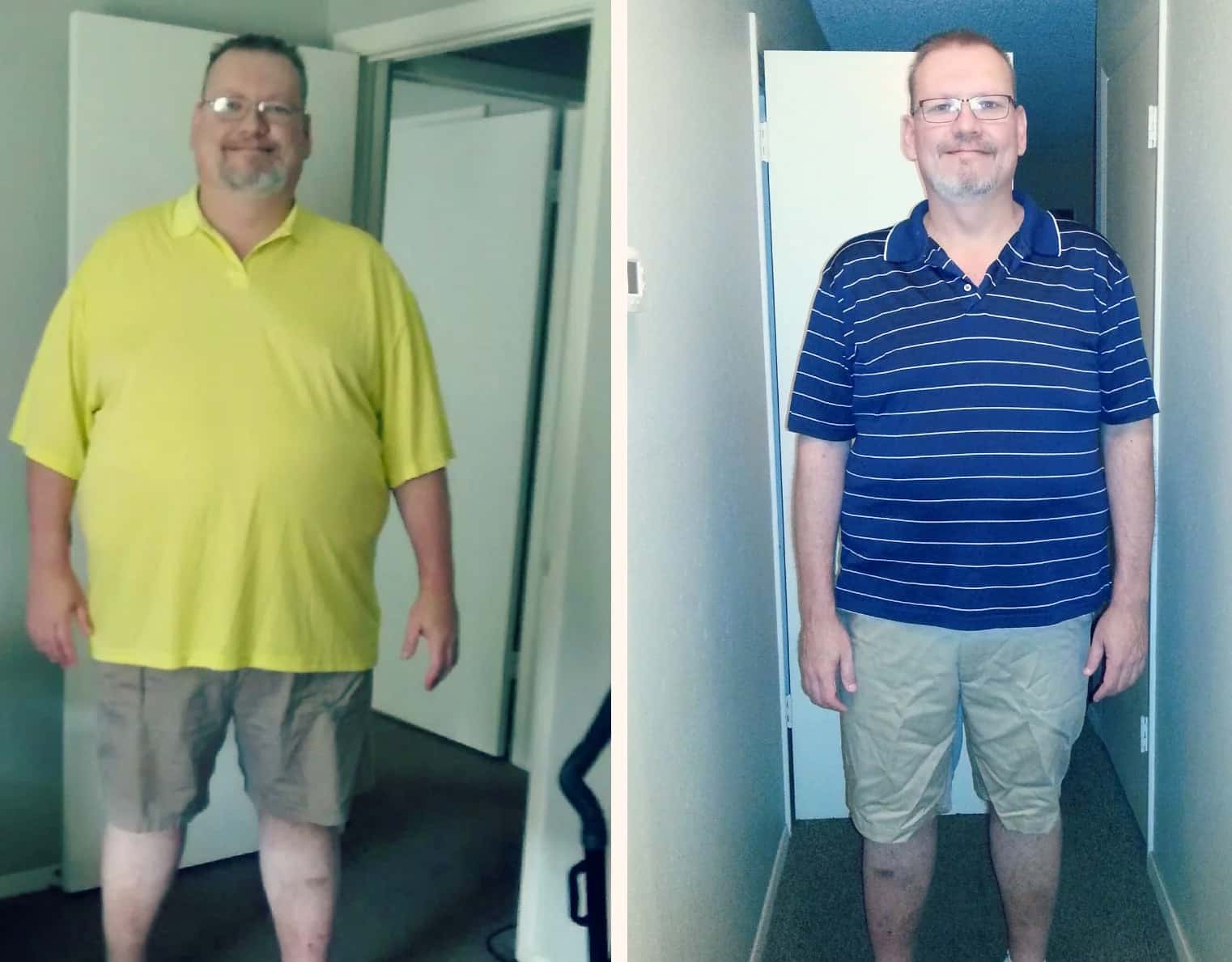 Weight Loss Surgery: “The Best Thing I’ve Ever Done”