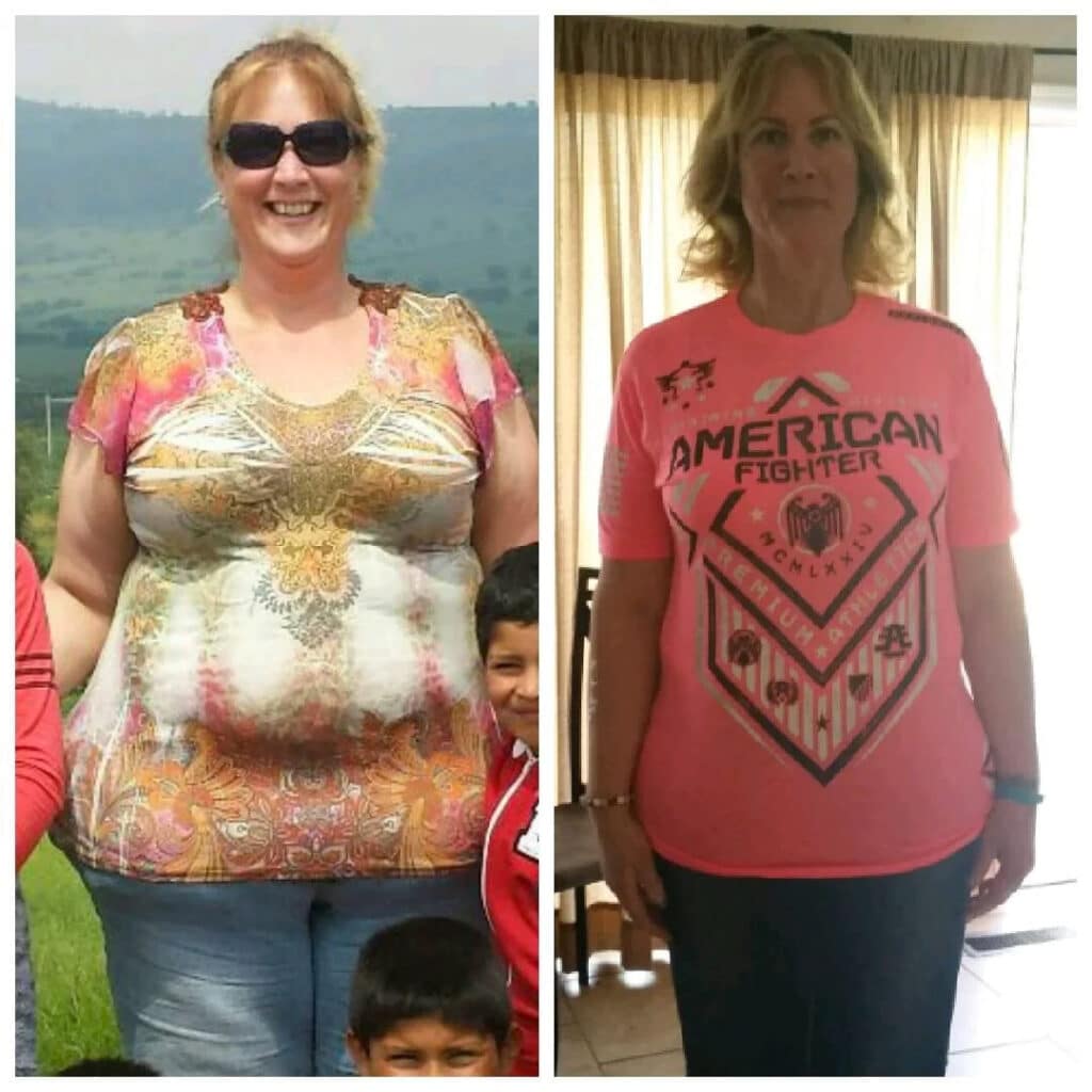 Nicolle's weight loss journey