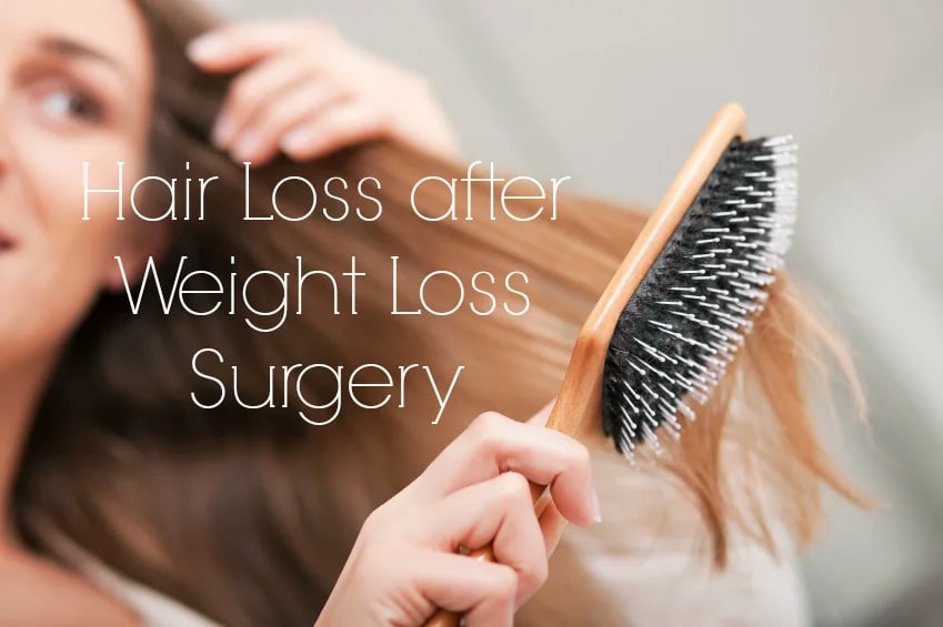 Facing Hair Loss after Weight Loss Surgery