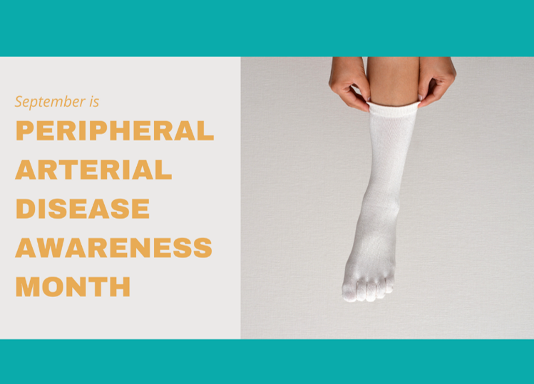 What is peripheral arterial disease?