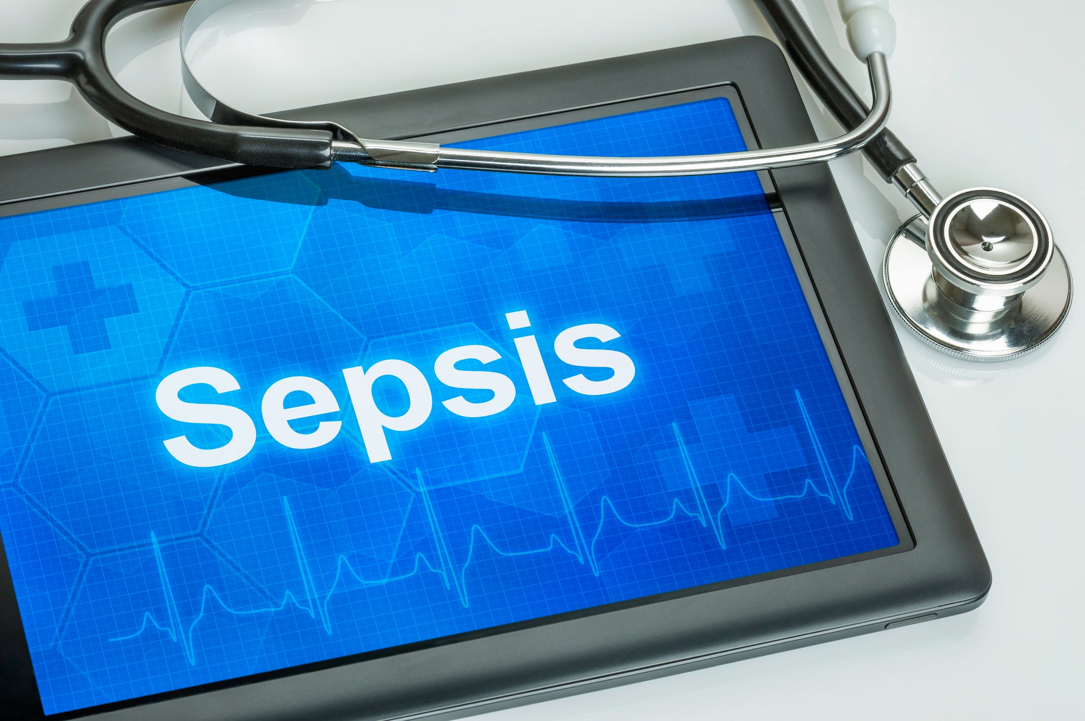 When dealing with sepsis, it’s a matter of T.I.M.E.