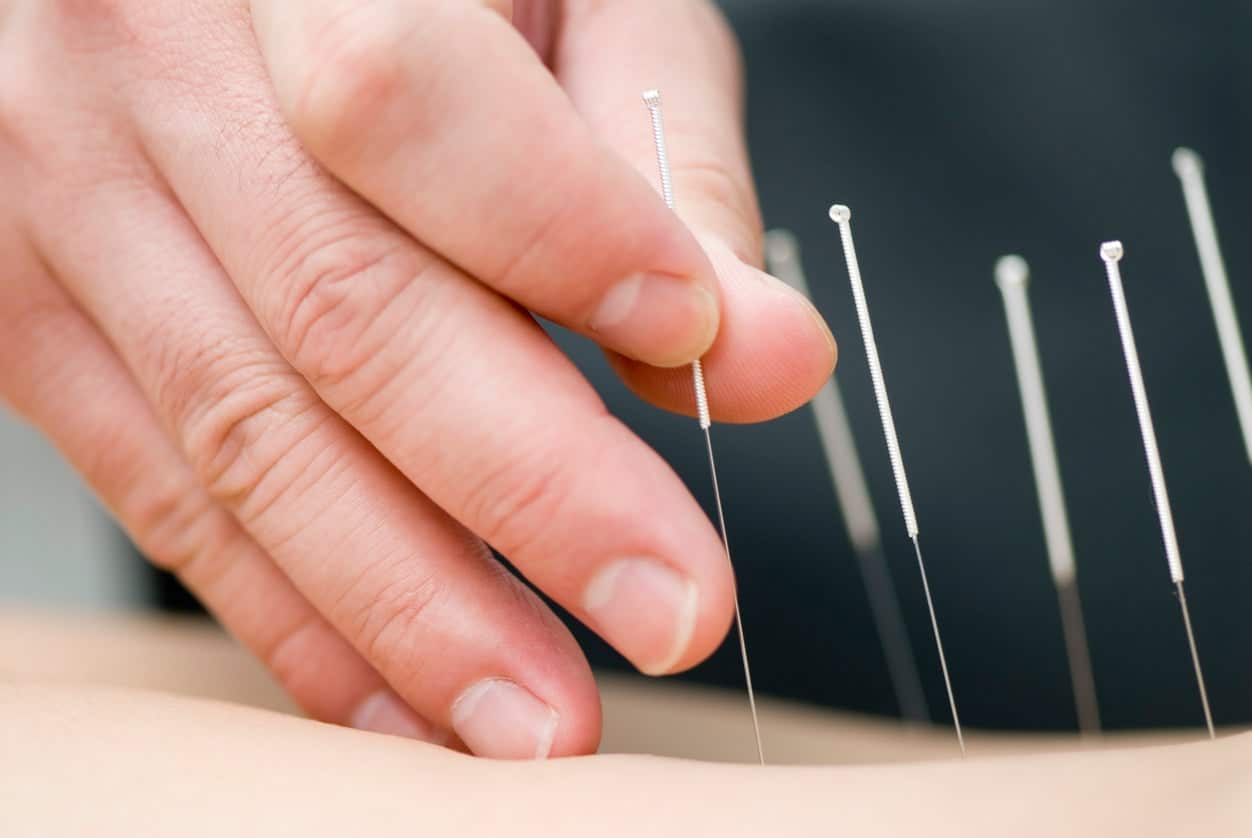 Acupuncture and other integrative therapies help breast cancer patients and survivors