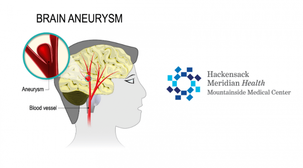 Aneurysm Awareness Month