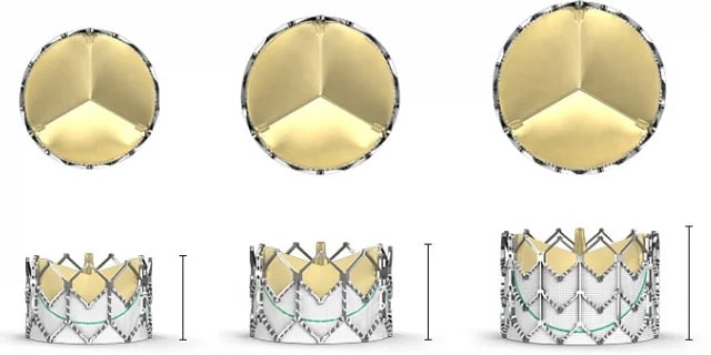 First in Oklahoma – TAVR with Edwards Sapien XT Valve