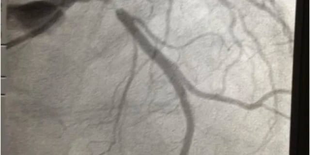 clear vein image