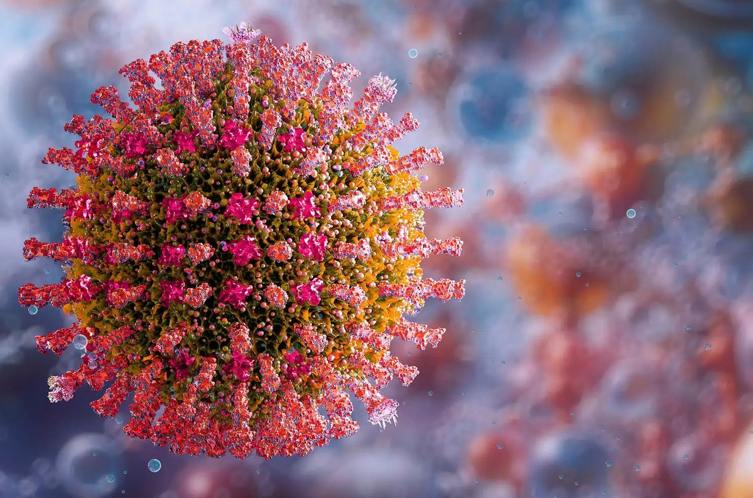 What is Measles?