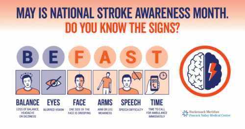National Stroke Awareness Month: Know the Signs and Act FAST