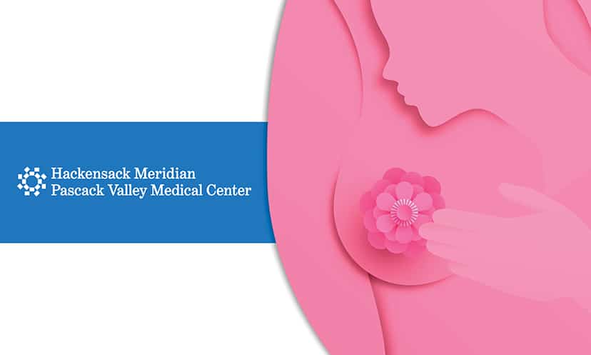 Illustration of a woman performing a breast self-exam