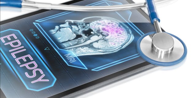 Epilepsy written on screen