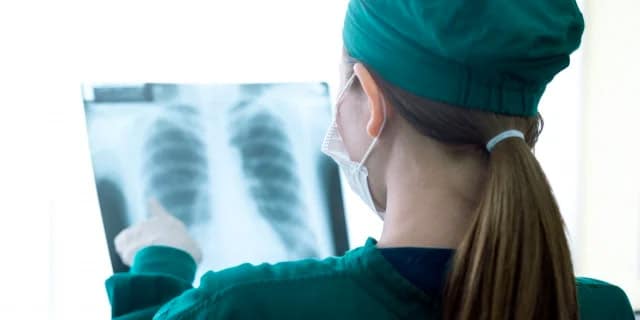 Long-Time Smokers Should Get Screened for Lung Cancer