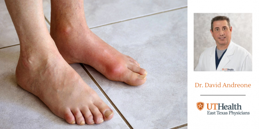 Gout for the holidays? No, thank you.