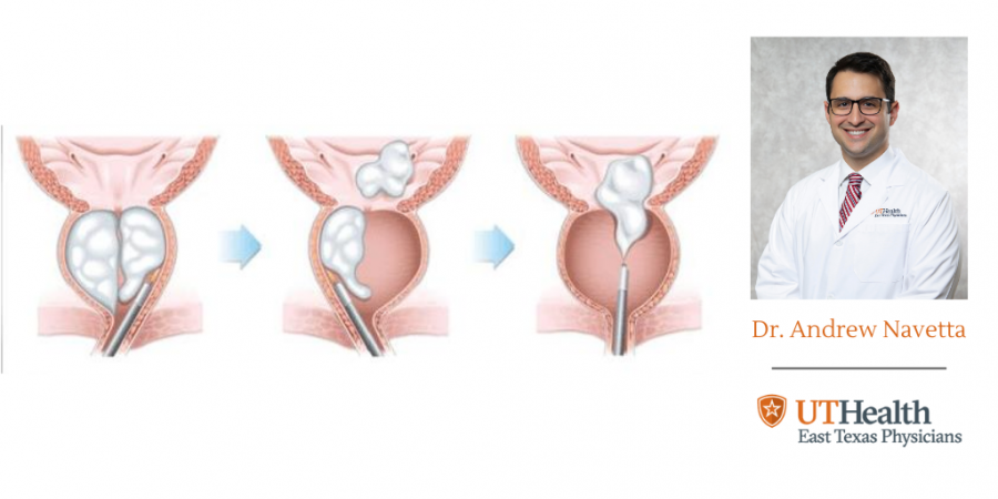 HoLEP Surgical Procedure