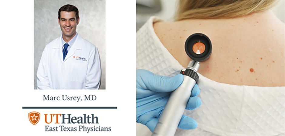 Skin Cancer: What you need to know