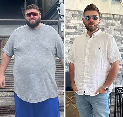 Mikes before and after weight loss photo