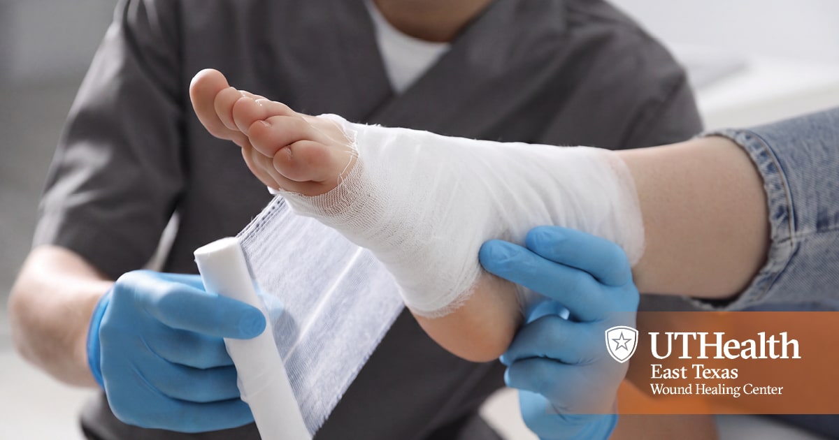 Diabetic Foot Ulcers: A Serious Complication of Diabetes – and How to Prevent Them